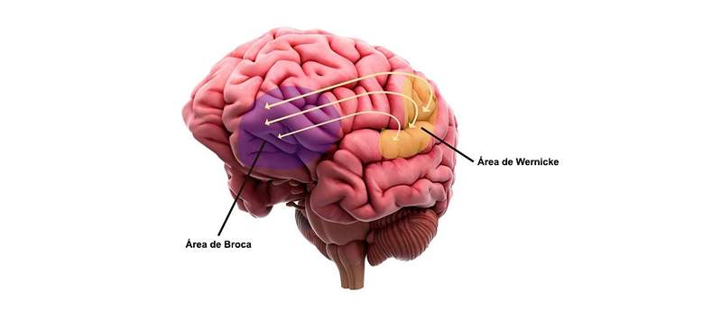 Area Wernicke dan hubungannya dengan bahasa